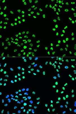 Immunocytochemistry/ Immunofluorescence: ATR [p Ser428] Antibody - Azide and BSA Free [NBP3-05447]